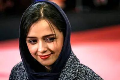 بیماری ترانه علیدوستی چیست ؟چرا دست‌های ترانه علیدوستی پیرشده است