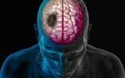 چگونه زمستان خطر سکته مغزی را افزایش می‌دهد؟