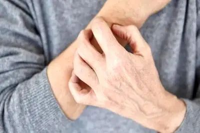 استرس جنگ و افزایش خشکی و التهاب پوست/ توصیه های طب ایرانی برای محافظت از پوست