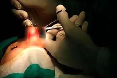 مرگ دختر ۲۷ ساله پس از عمل زیبایی بینی در تهران