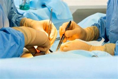 نجات جان کودک 5 ساله با جراحی نادر پیوند کامل پوست صورت در تبریز